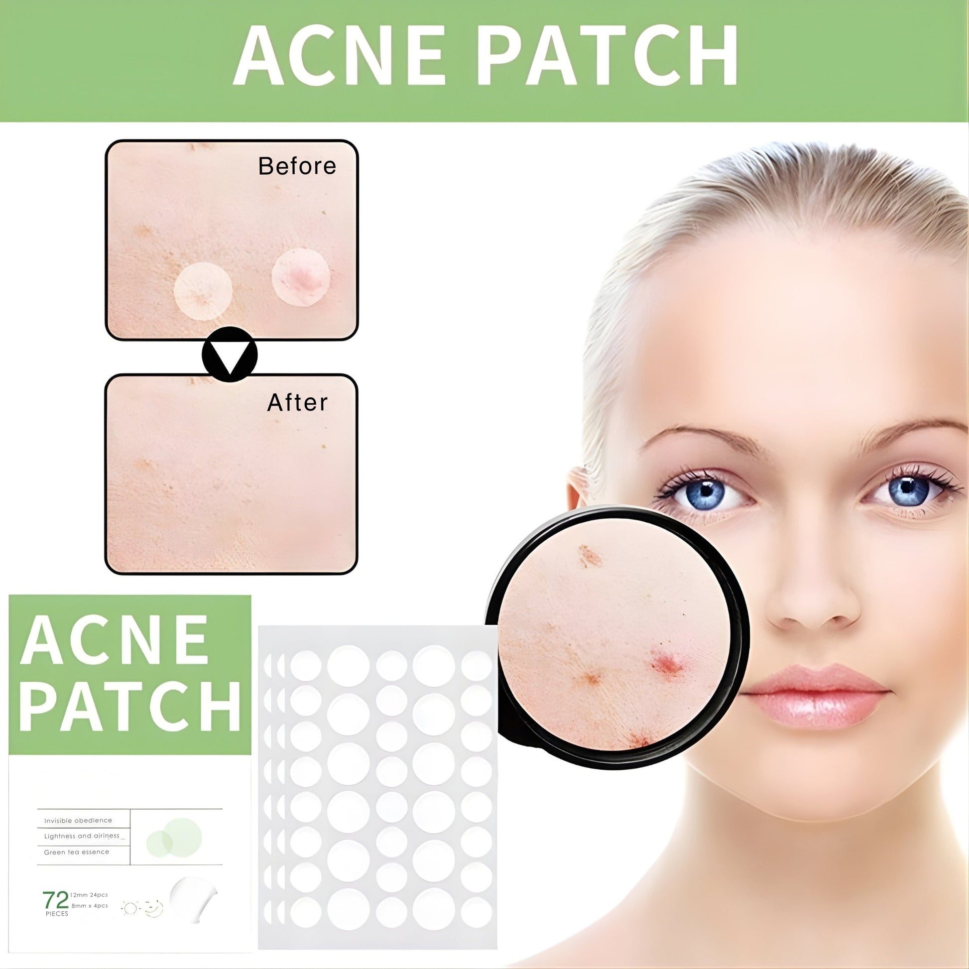 Anti-Acne Concealer Patch | Invisible Blemish Protection | 72 Patches