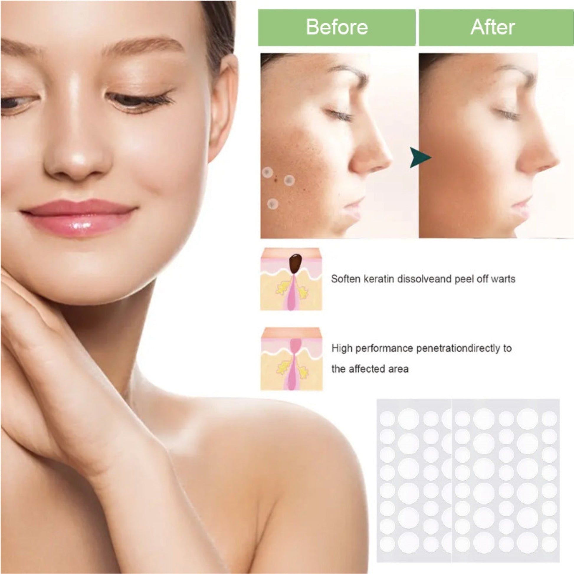 Anti-Acne Concealer Patch | Invisible Blemish Protection | 72 Patches
