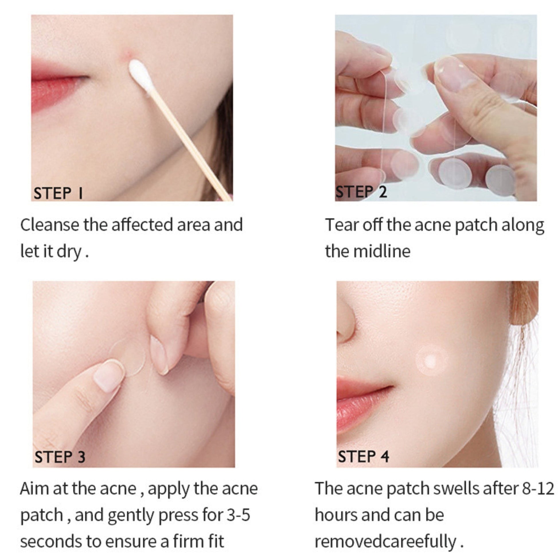 Anti-Acne Concealer Patch | Invisible Blemish Protection | 72 Patches