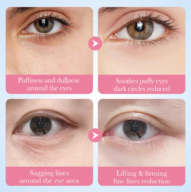 Collagen Under-Eye Patches | Hydrating for Puffiness & Dark Circles | 80g
