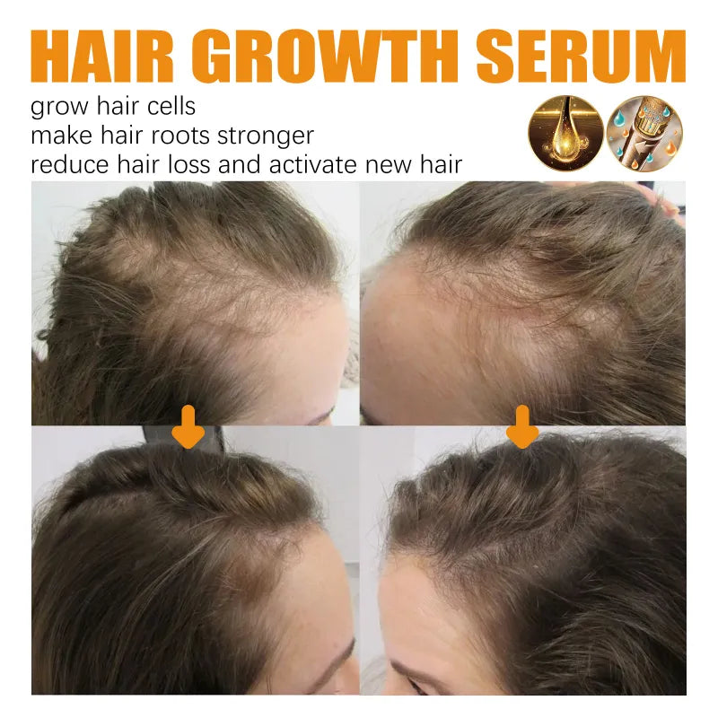 Biotin Hair Growth Spray | Castor Oil, Ginseng & Ginger Root Extract | 30ml