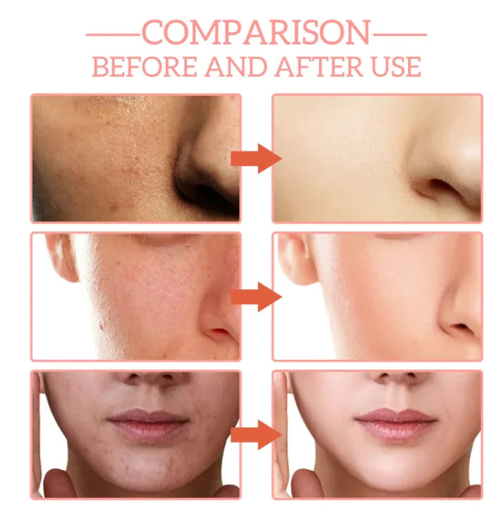 GlowBoost 5-in-1 Anti-Aging Serum | Niacinamide, Hyaluronic Acid & Collagen for Radiant Skin
